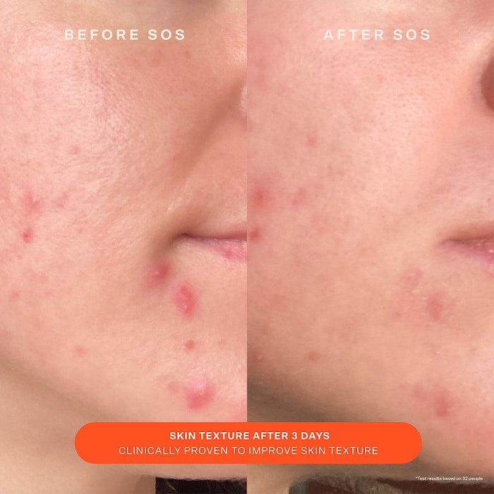 Tower 28 Beauty
SOS Daily Skin Barrier Redness Recovery Moisturizer