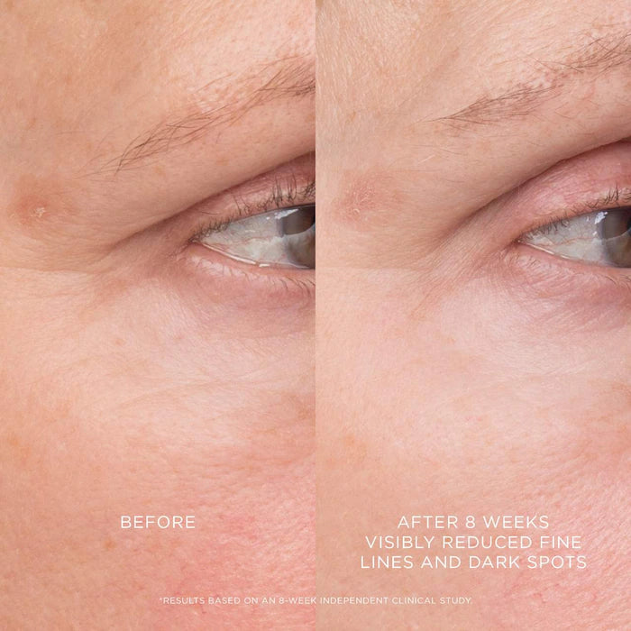 Hourglass 
Equilibrium Resurfacing Retinoid Treatment
