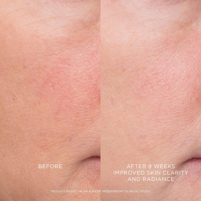 Hourglass 
Equilibrium Resurfacing Retinoid Treatment